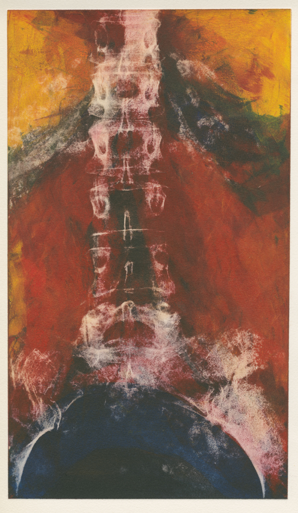 莉莎白．詹姆森《疊放》，取自藝術家脊柱的X光照。圖／取自_藝術家創作官網。.jpg